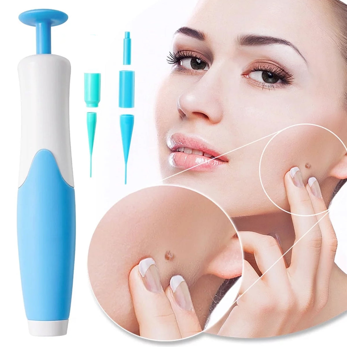 Skin Tag Remover Kit 2 In 1 For Micro To Large (2 Mm - 8 Mm 1 Set) - Happy Price - Image 3