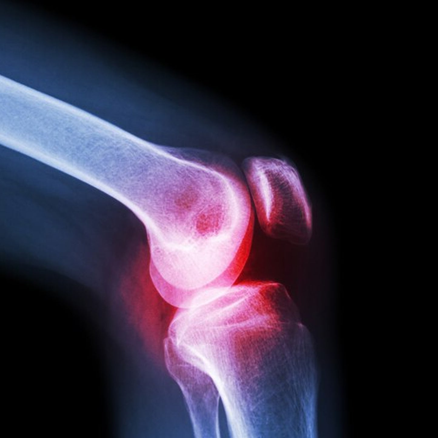 (Large) Knee Cap For Knee Support - Happy Price - Image 4