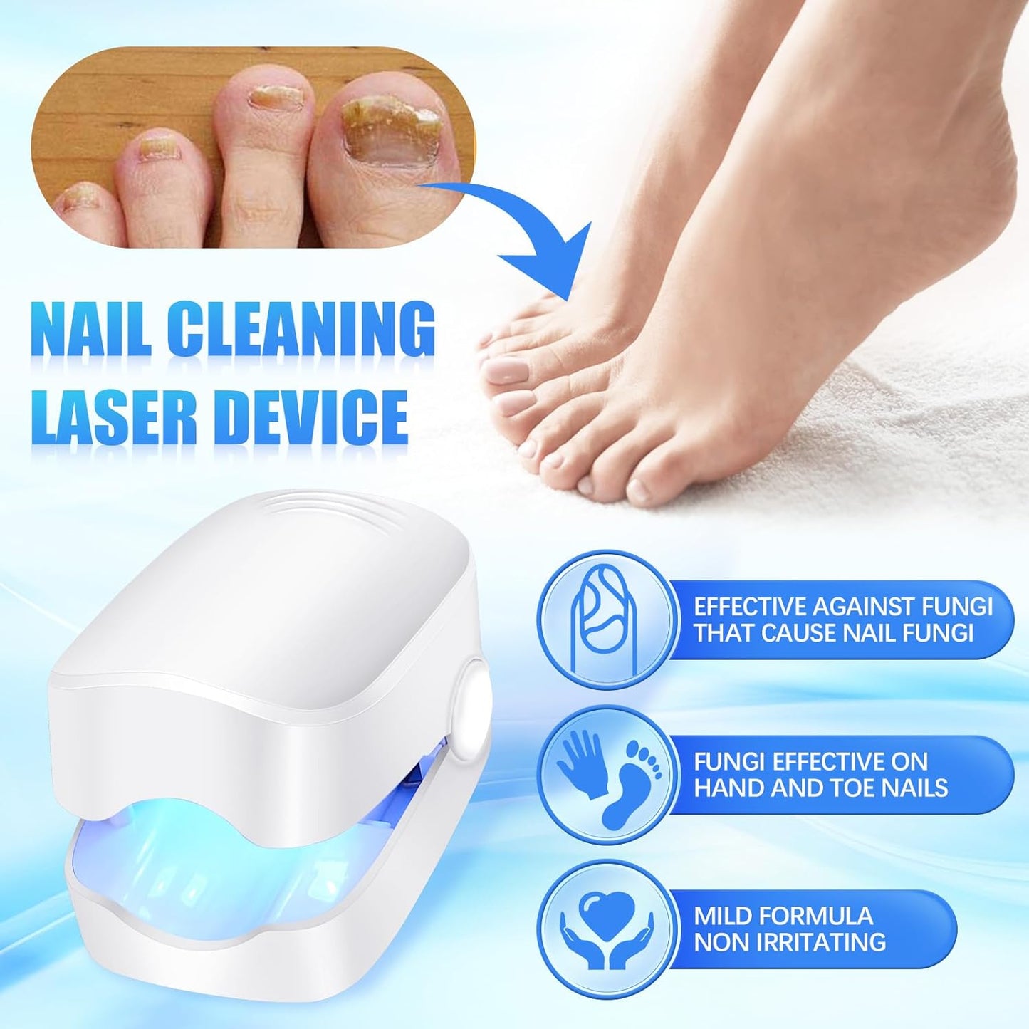 Rechargeable Nail Fungus Treatment For Toenail Toe Nail Fungal Treatment Nail Fungus Laser Device Anti-fungal Nail Treatment For Hand Feet Infections Remover For Home Use - Happy Price - Image 2