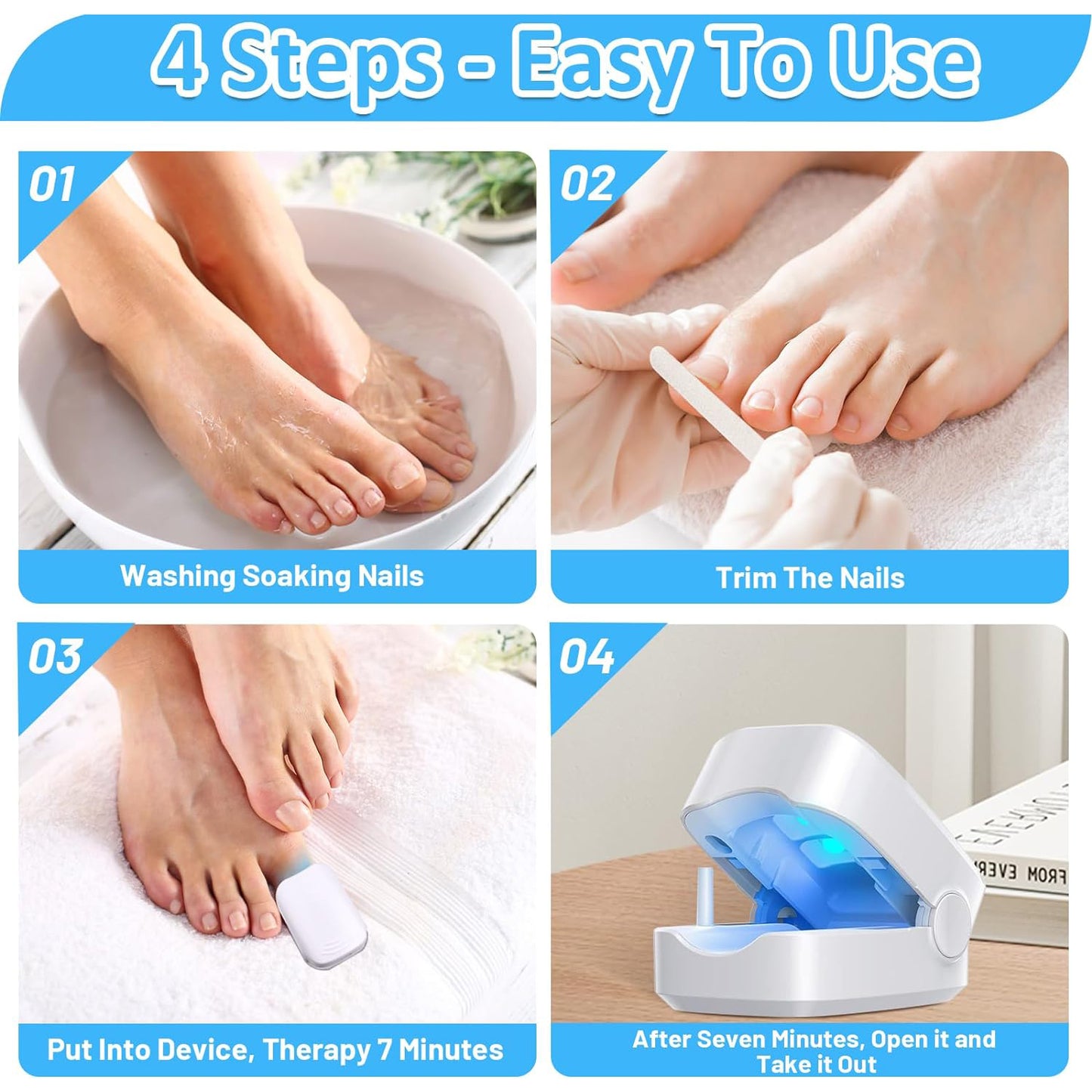 Rechargeable Nail Fungus Treatment For Toenail Toe Nail Fungal Treatment Nail Fungus Laser Device Anti-fungal Nail Treatment For Hand Feet Infections Remover For Home Use - Happy Price - Image 5