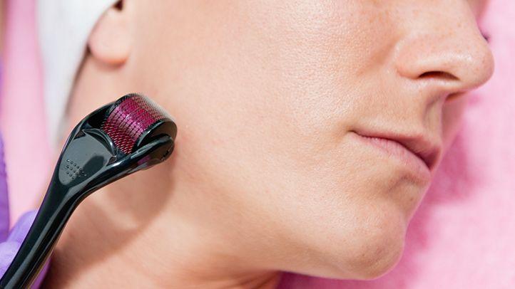 Derma Roller Anti Ageing And Facial Scrubs Polishes Scar Removal Hair Regrowth - Happy Price - Image 7