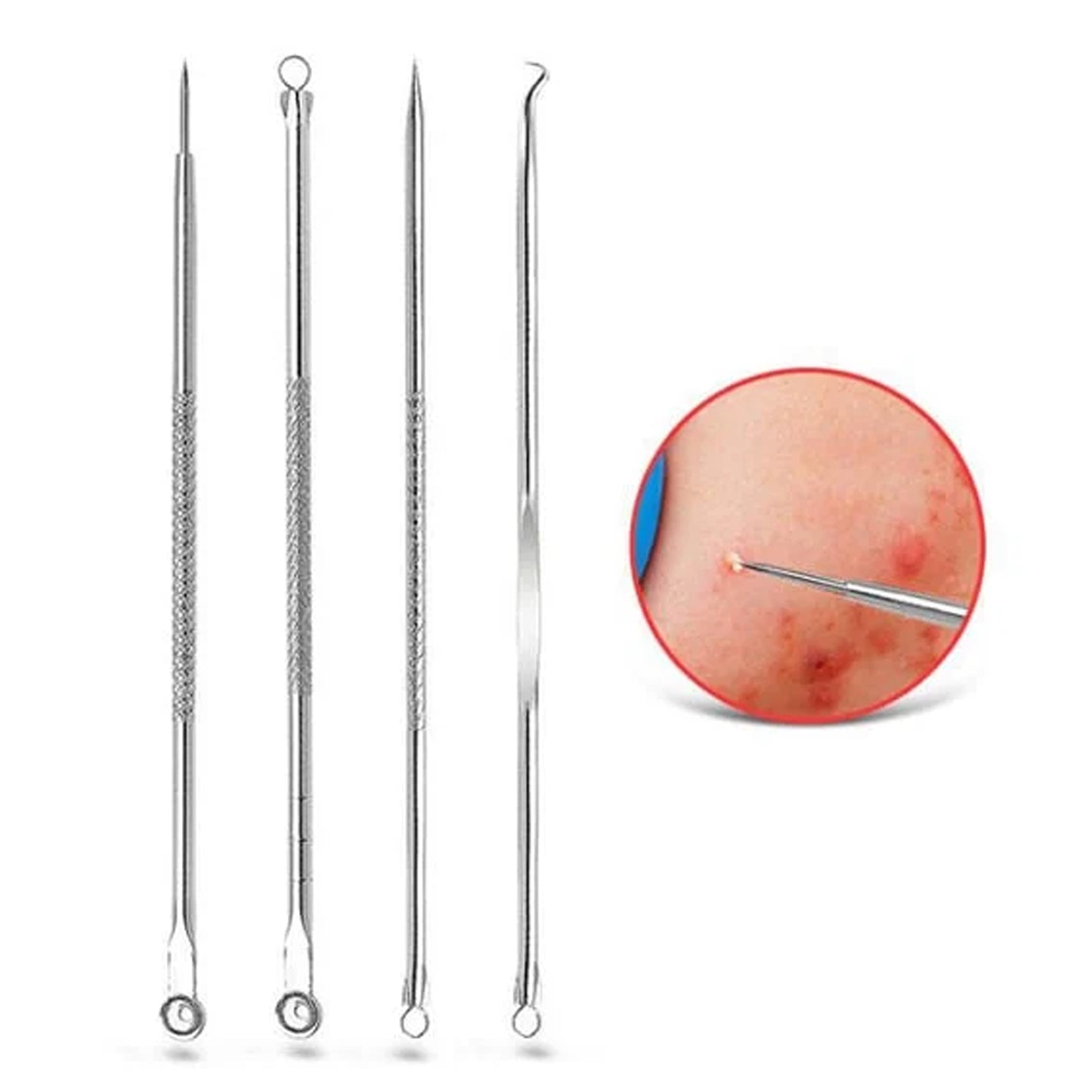 Blackhead Remover 4-in-1 Stainless Steel Pimple Extractor Tool (1 Pc) - Happy Price - Image 6