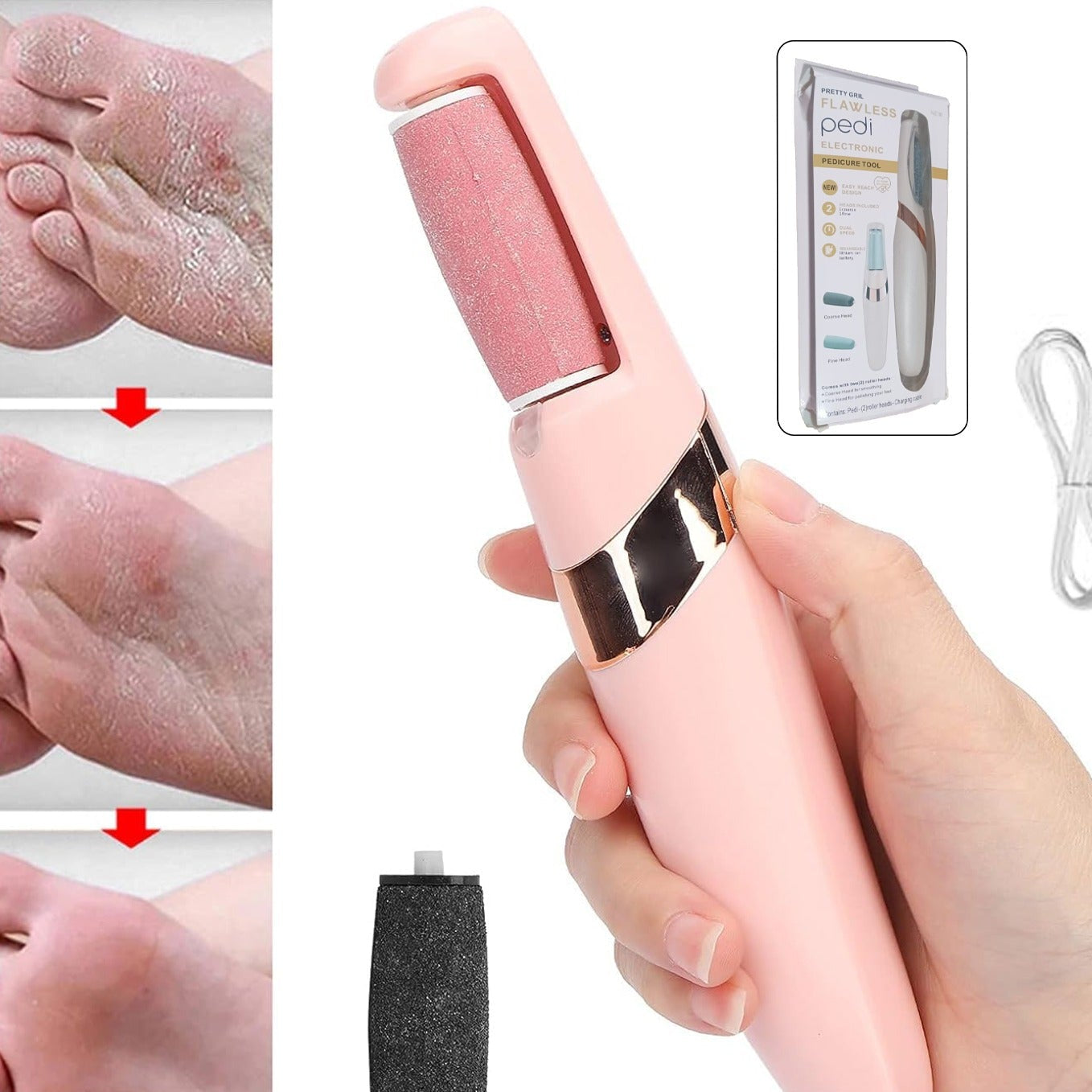 Flewless Pedi Electronic Pedicure Tool (1 Set) - Happy Price - Image 1
