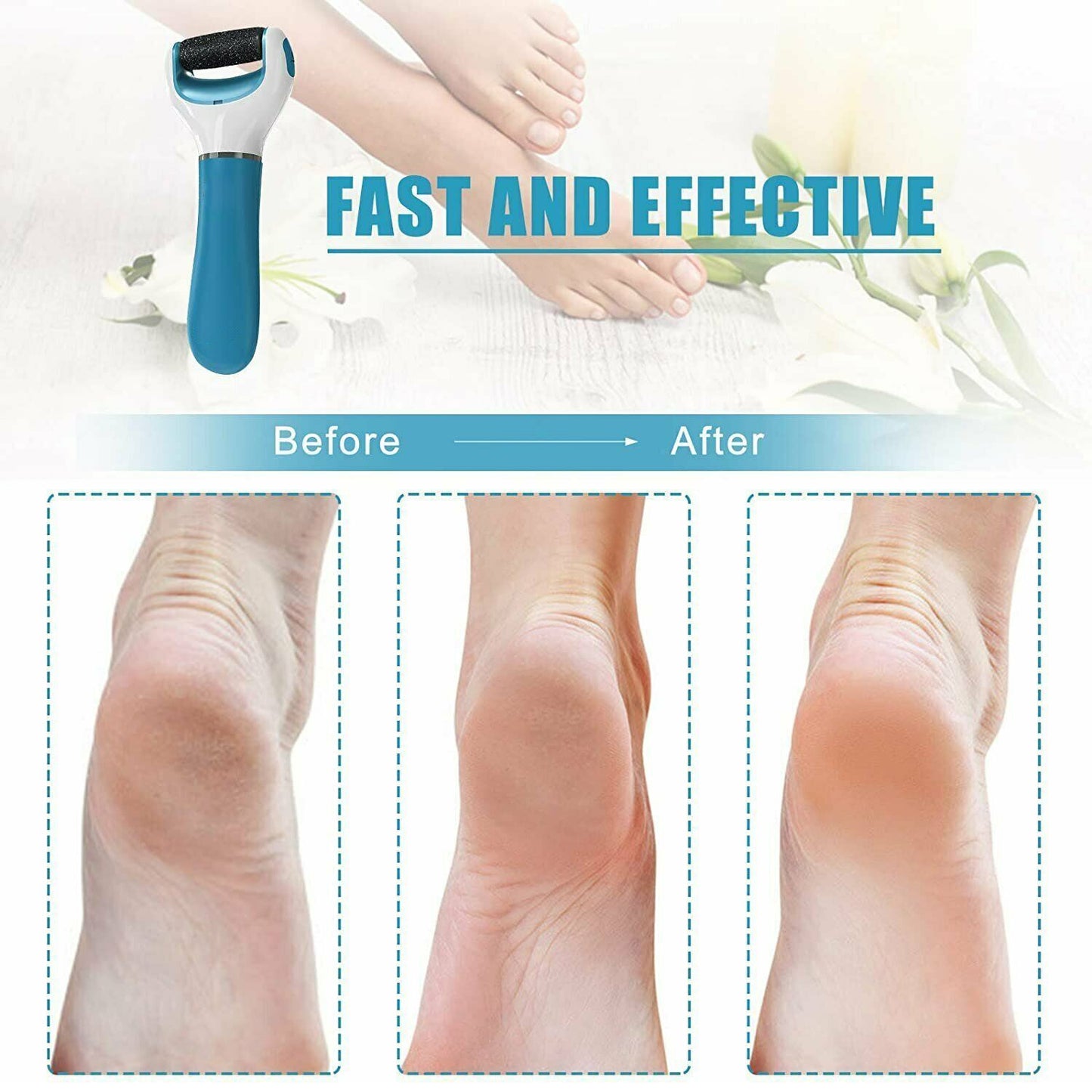 Electric Foot Callus Remover for Smooth Feet - Battery & USB Powered - Happy Price - Image 7