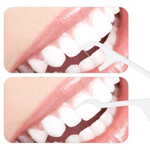 Oral Care Dental Floss Toothpick Sticks - Happy Price - Image 4