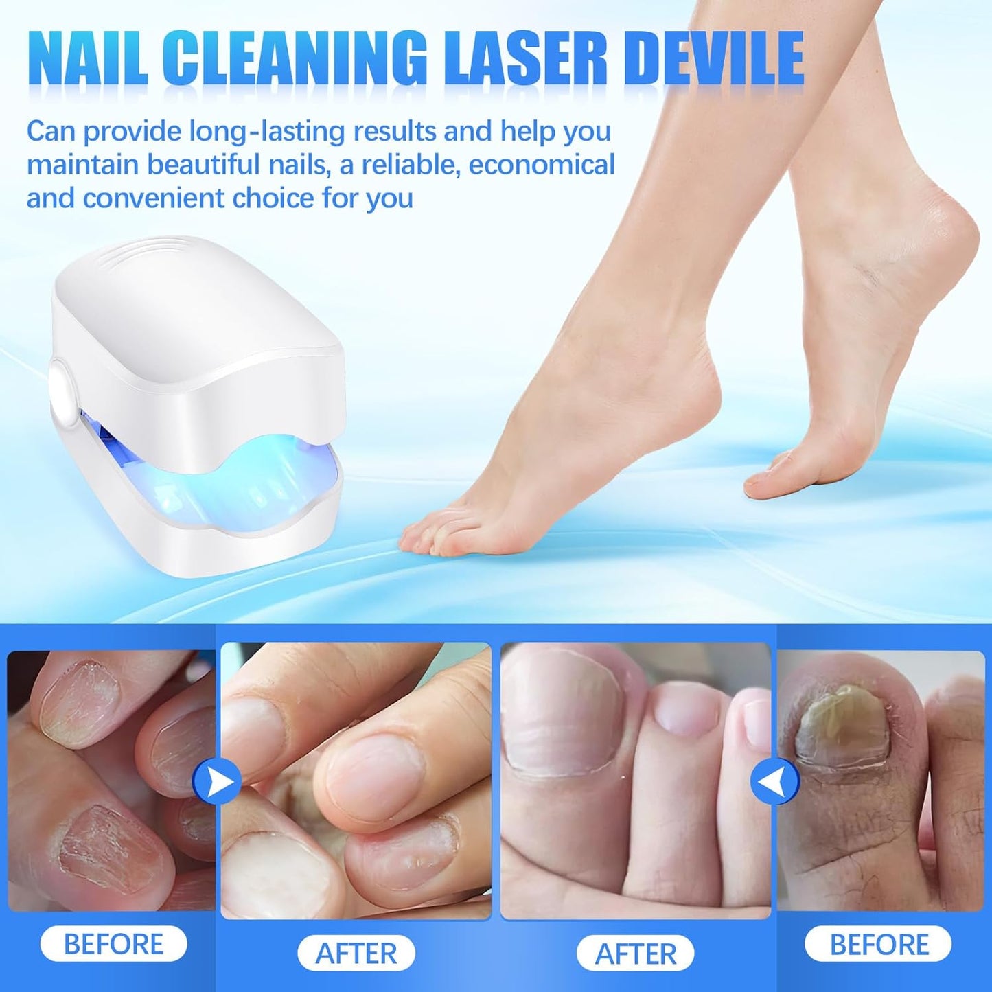 Rechargeable Nail Fungus Treatment For Toenail Toe Nail Fungal Treatment Nail Fungus Laser Device Anti-fungal Nail Treatment For Hand  Feet Infections Remover For Home Use - Happy Price - Image 4