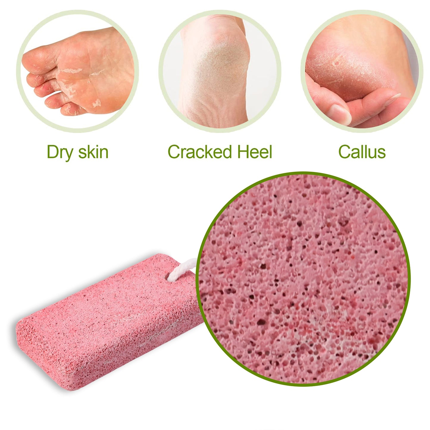 Natural Pumice Stone for Foot Callus Removal - Exfoliating Dead Skin Smoother (1 Pc) - Happy Price - Image 3