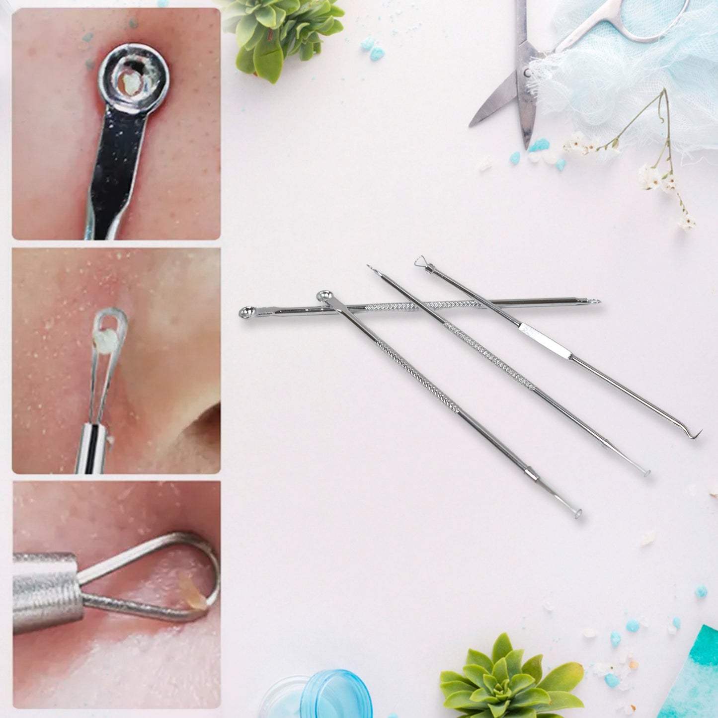 Blackhead Remover 4-in-1 Stainless Steel Pimple Extractor Tool (1 Pc) - Happy Price - Image 3