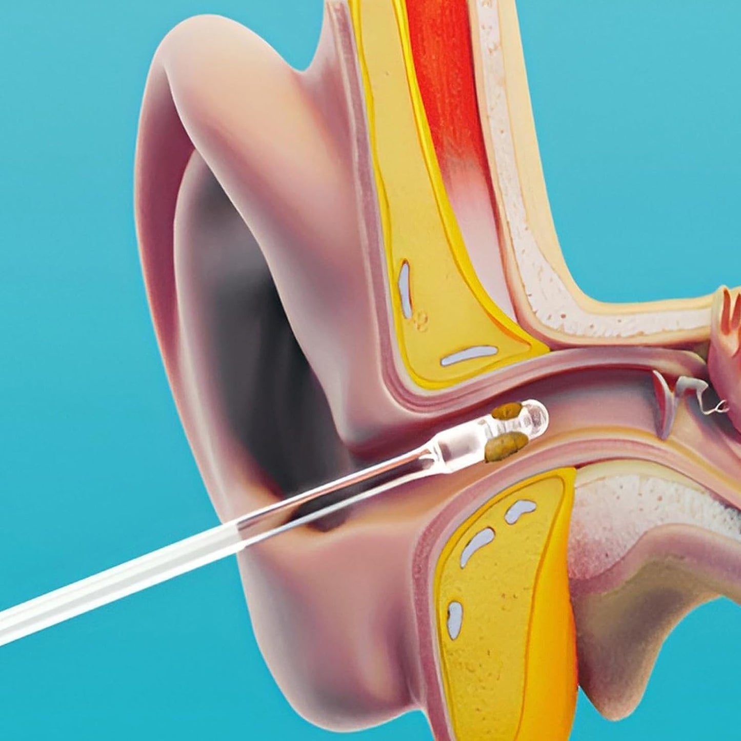 Ear Wax Cleaner Stick Silicone Reusable Sticky Ear Wax Removal Kit (12 Pcs Set) - Happy Price - Image 3