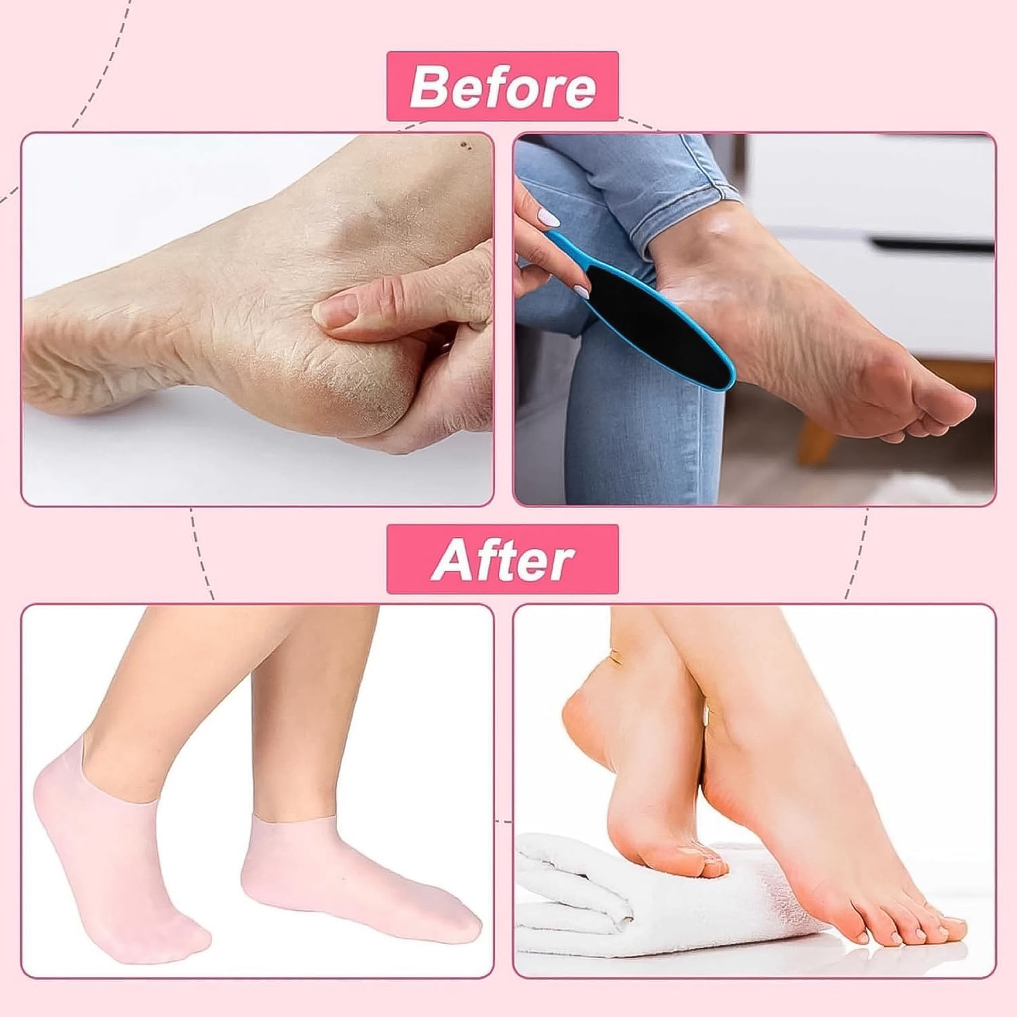 Silicone Moisturizing Socks (1 Pair) - Happy Price - Image 5
