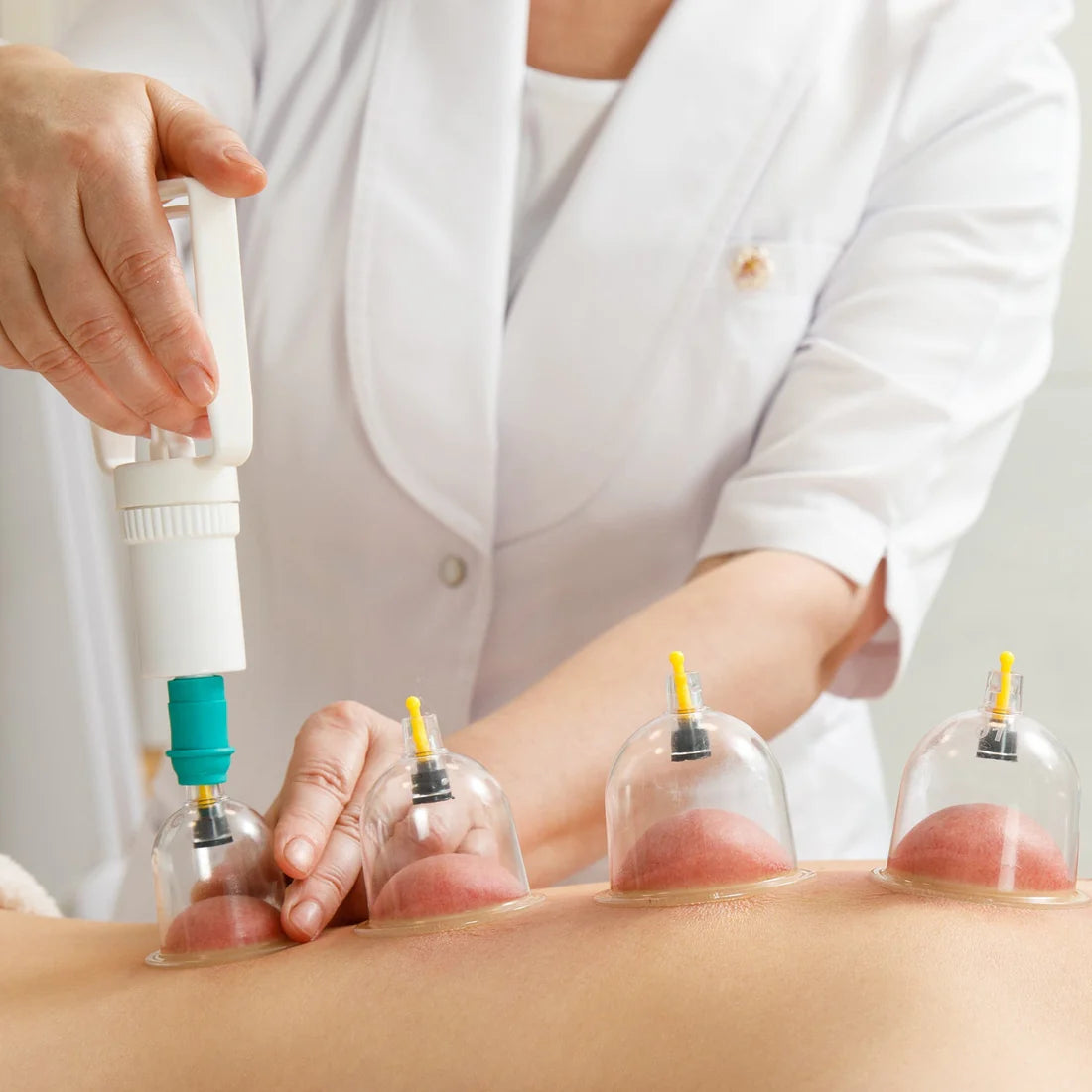 Vacuum Cupping Therapy Set - 6 Piece Kit for Muscle Relaxation - Happy Price - Image 7